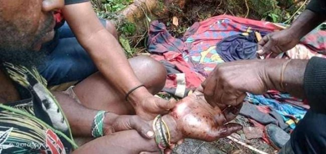TPNPB Organisasi Papua Merdeka Mengakui 4 Anggotanya Tertembak Mati, Dua Luka-Luka