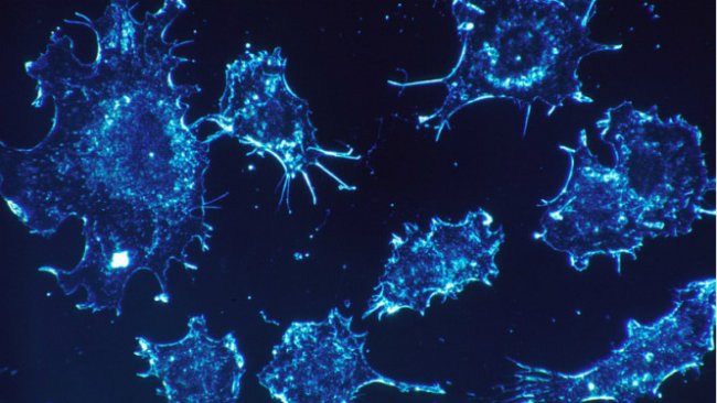 Para Ilmuwan Temukan Obat Baru Kanker, Imunoterapi