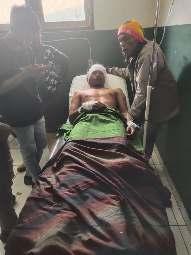 Tukang Ojek di Puncak Jaya Dibacok Orang tak Dikenal Tukang Ojek di Puncak Jaya Dibacok Orang tak Dikenal