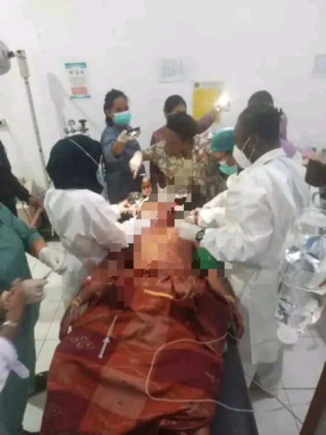 Seorang Warga Dibacok Dengan Senjata Tajam di Yahukimo, Diduga Dilakukan KKB