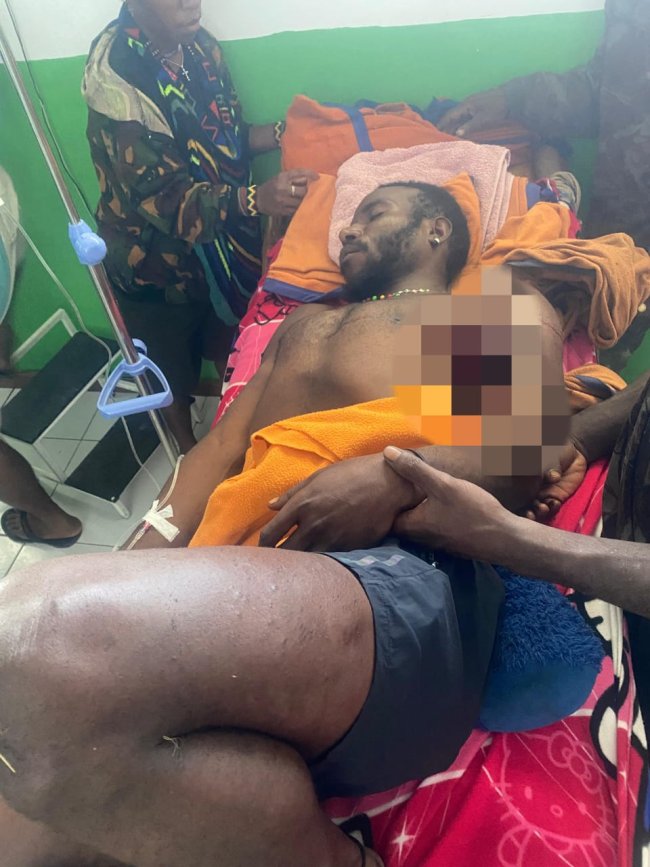 KKB Pimpinan Kalenak Murib Serang Warga Sipil dan Bakar Honai di Puncak, Tiga Korban Meninggal Dunia