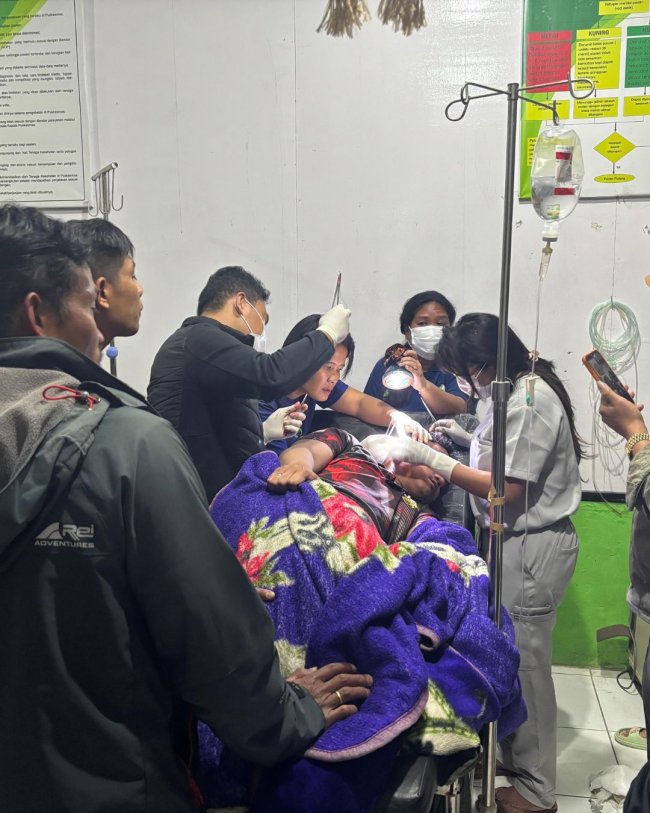 Personel Polres Intan Jaya Alami Luka Akibat Dianiaya KKB