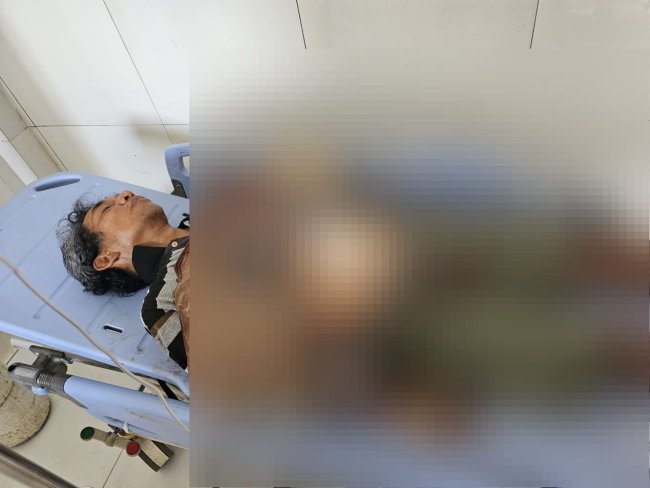 Diduga Alami Gangguan Mental, Seorang Juru Parkir Tusuk Perutnya dengan Pisau di Sentani