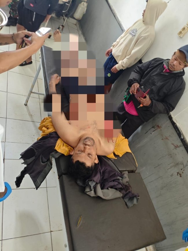 Dua Tukang Ojek Jadi Korban Penganiayaan di Deiyai, Satgas Ops Damai Cartenz Dalami Pelaku