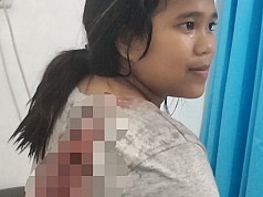 Dua Korban Penyerangan Warga Di Yahukimo Dirujuk ke Jayapura  Dua Korban Penyerangan Warga Di Yahukimo Dirujuk ke Jayapura