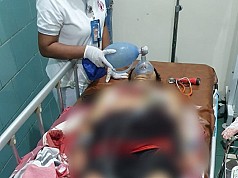 Pria Paruh Baya di Jayapura Ditemukan Bersimbah Darah, Diduga Bunuh Diri