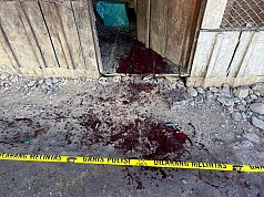 Seorang Pedagang di Intan Jaya Ditebas Parang OTK Seorang Pedagang di Intan Jaya Ditebas Parang OTK