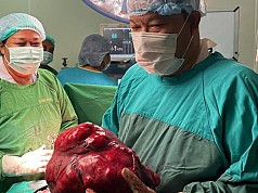 Dokter Spesialis Kandungan RSUD Jayapura Berhasil Mengoperasi Pasien Tumor Mioma Uteri Seberat 5,67 Kg  Dokter Spesialis Kandungan RSUD Jayapura Berhasil Mengoperasi Pasien Tumor Mioma Uteri Seberat 5,67 Kg