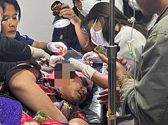 Polisi Intan Jaya Luka Dianiaya OTK, Diduga KKB Terlibat Polisi Intan Jaya Luka Dianiaya OTK, Diduga KKB Terlibat